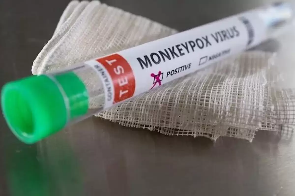 درخواست خرید واکسن علیه موارد احتمالی آبله میمونی