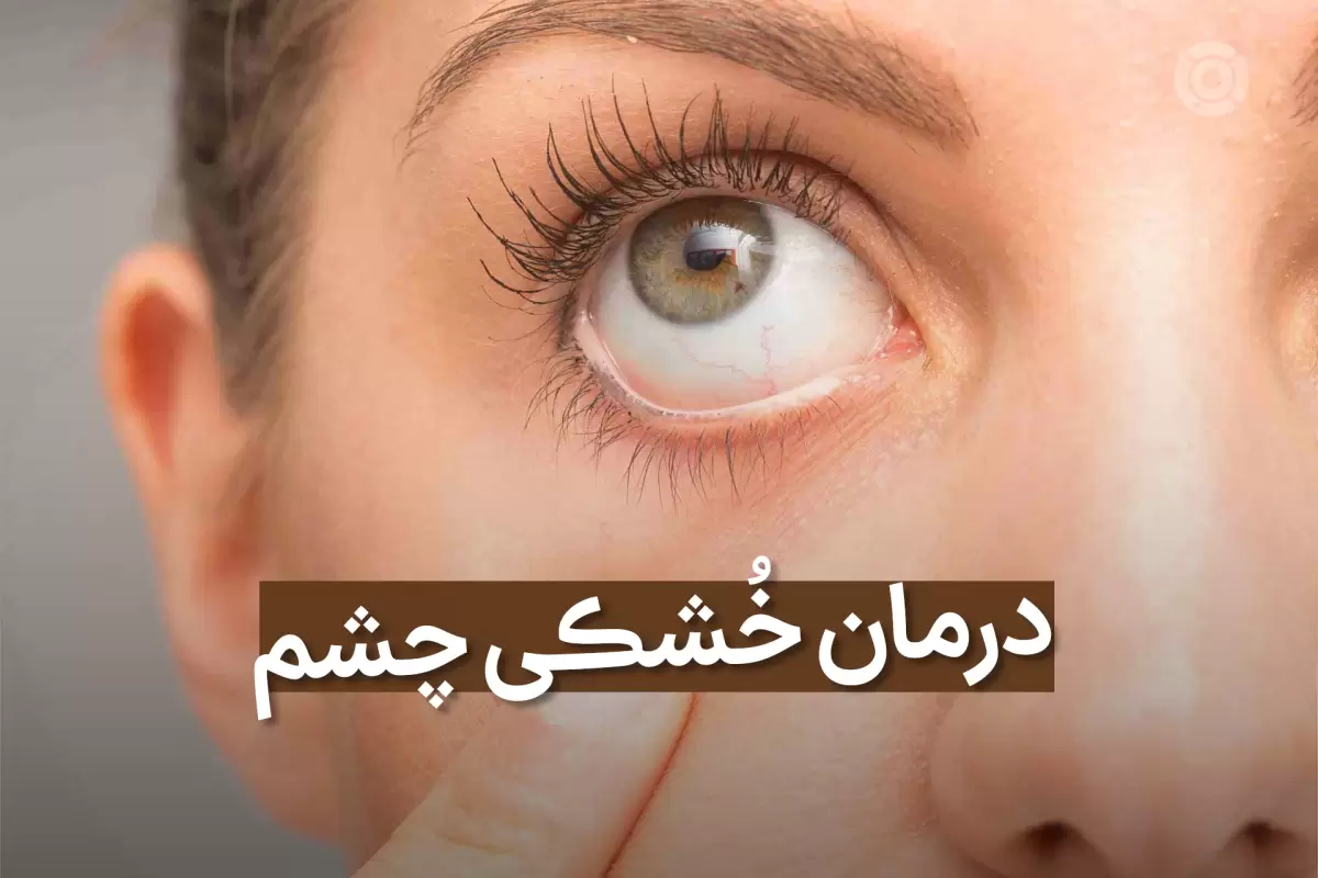 خشکی چشم چیست و آیا باعث نابینایی می شود؟ علت، علائم و درمان