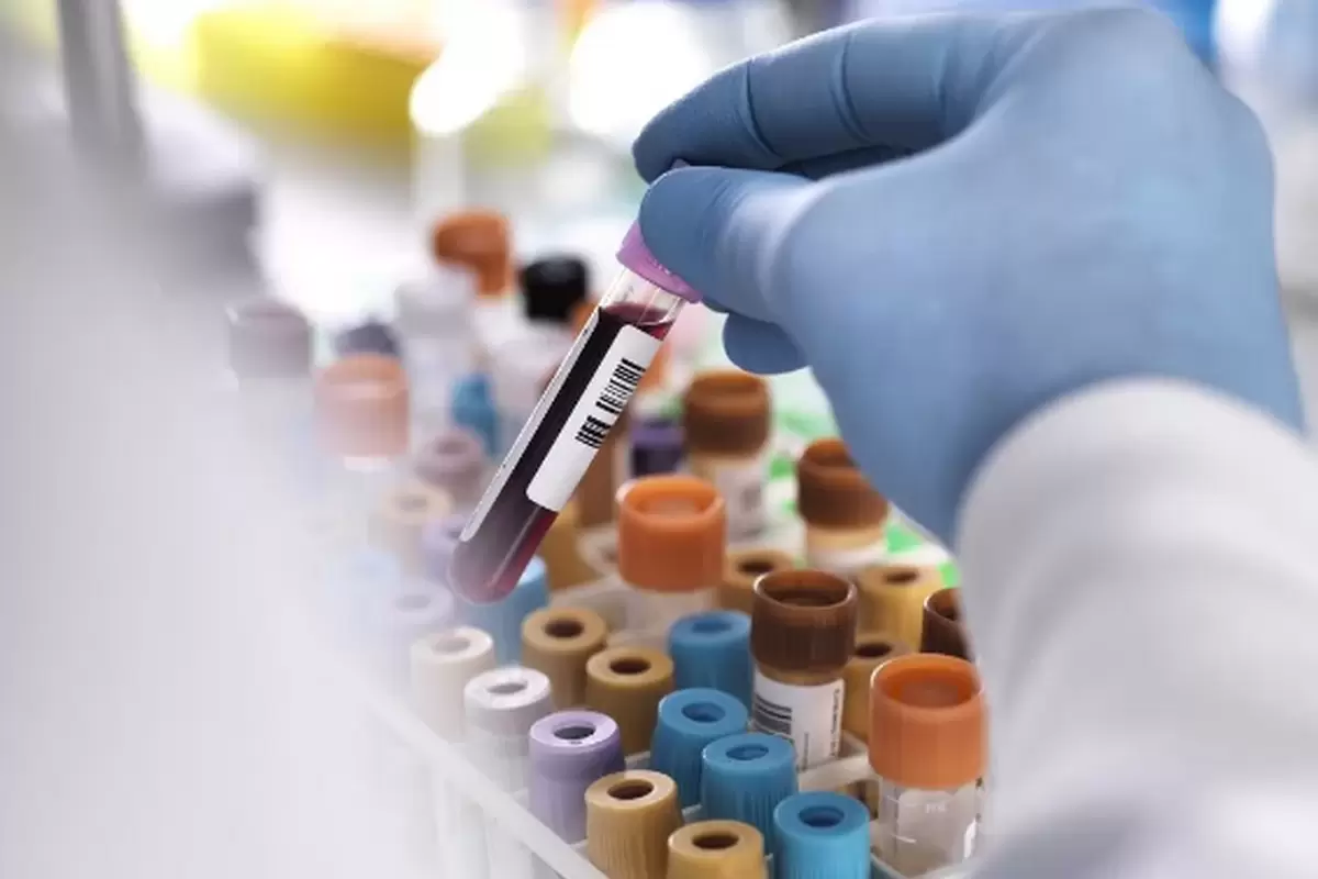 اولین آزمایش خون برای ده‌ها سرطان ارثی تأیید شد