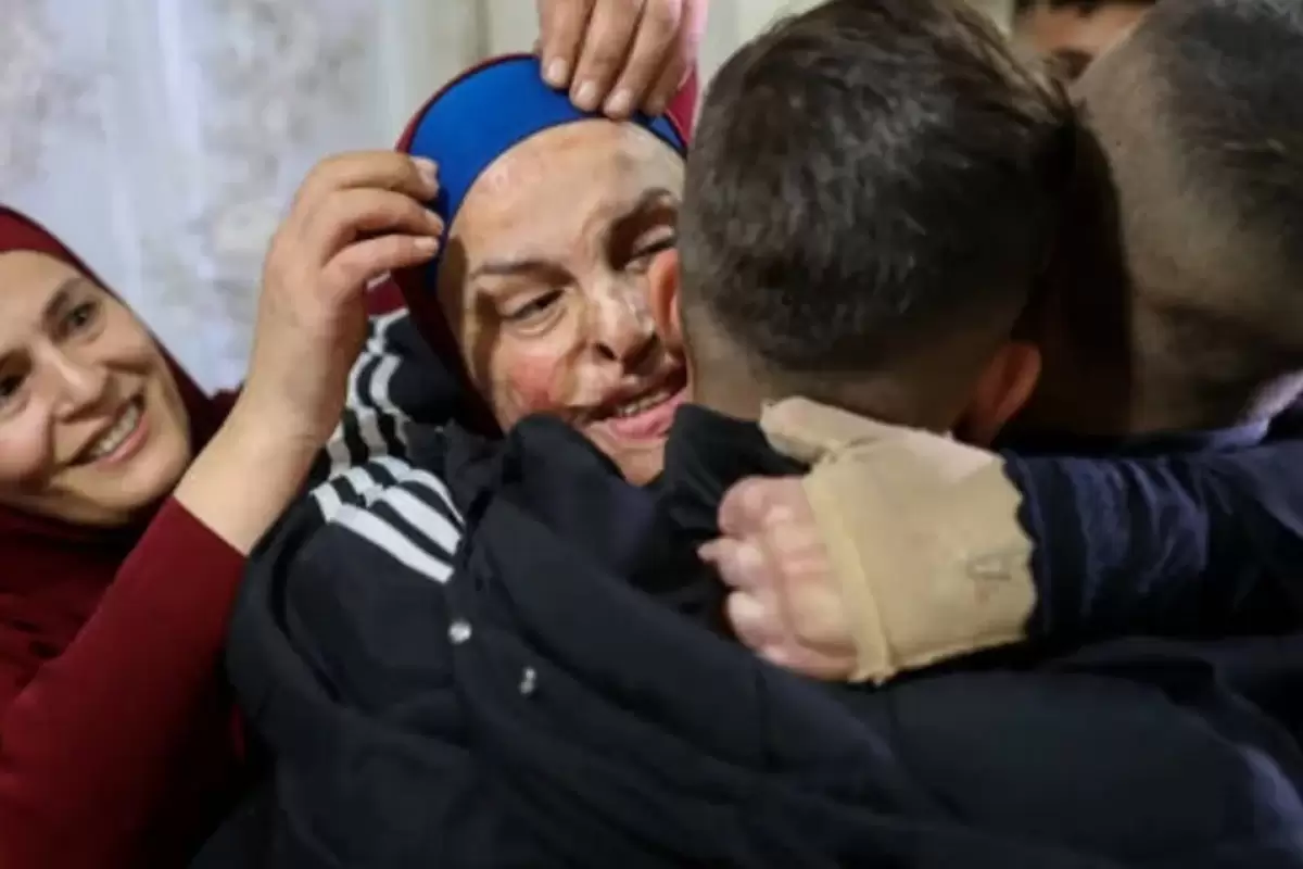 (ویدئو) راز صورت سوخته زن فلسطینی که از اسارت آزاد شد