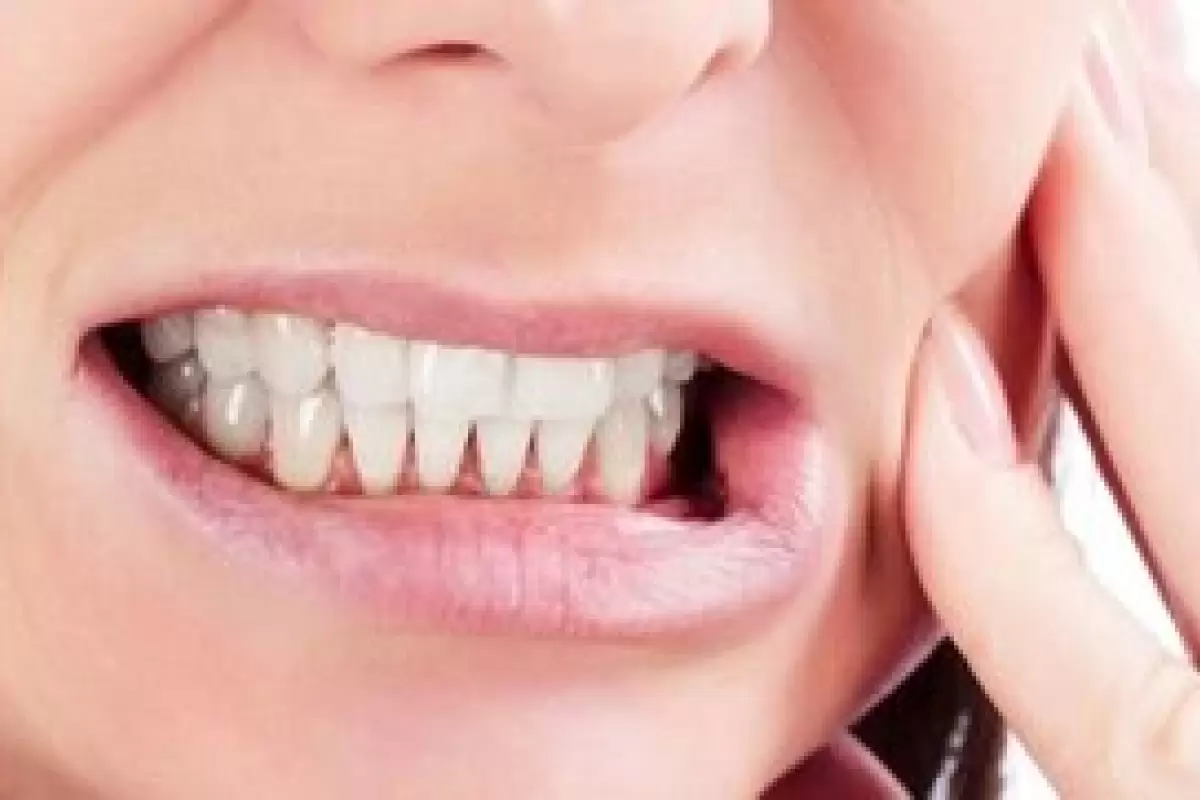 مایعی که از پوسیدگی دندان جلوگیری می‌کند