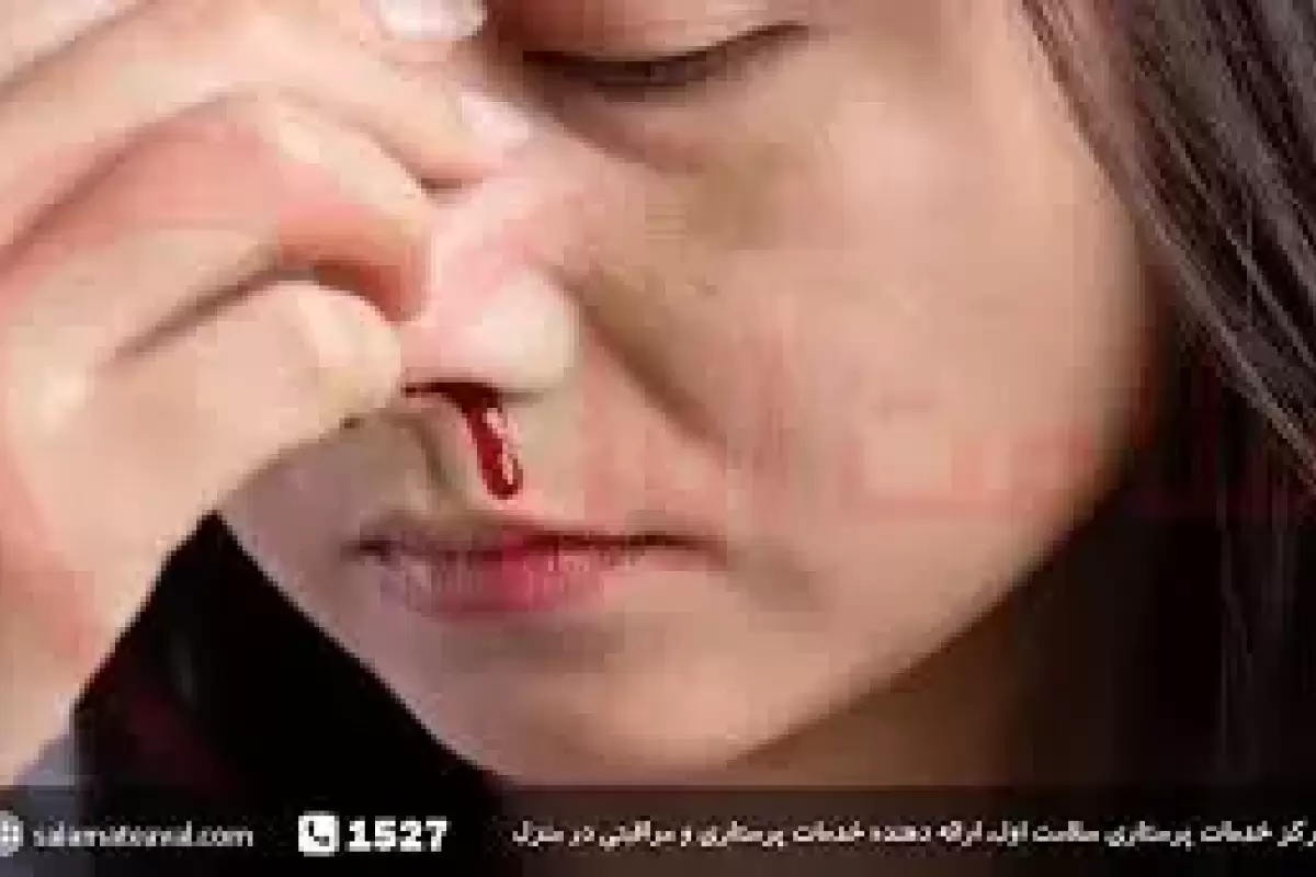با خون دماغ گرمی‌ هوا چه کنیم