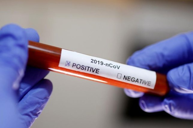 ﻿ ۴ فرد مبتلا به ویروس کرونا در گلپایگان شناسایی شدند