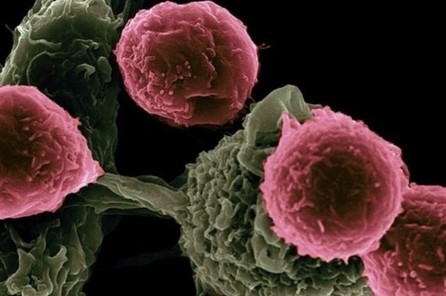 شایع‌ترین سرطان‌های زنان و مردان کدامند؟