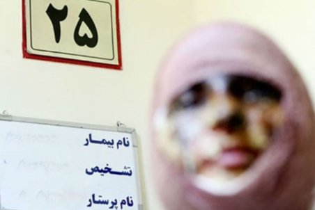 آذربایجان شرقی|مرد اسیدپاش در تبریز قربانی اسیدپاشی شد