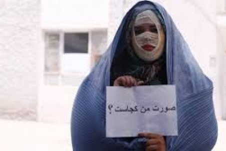 روی سیاه قانون در مقابله با اسیدپاش‌ها!