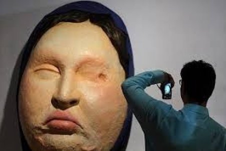 آیینه شکسته راز اسیدپاشی خانوادگی را فاش کرد