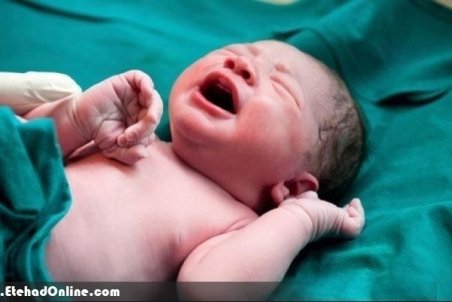 سکوت درباره خطرات زایمان‌های لاکچری