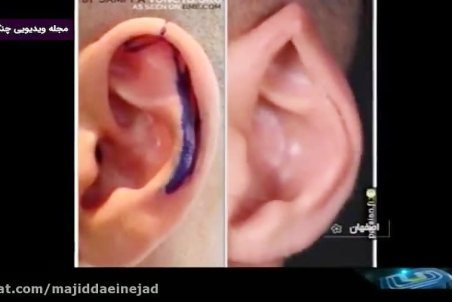 افراد غیرمتخصص جراحی گوش الاغی و چشم گربه‌ای انجام می‌دهند