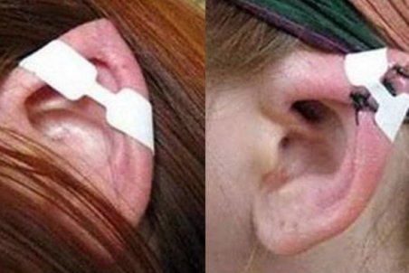 خط و نشان براي حقِ بر بدن