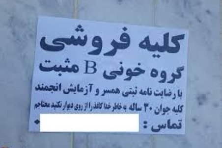 تبلیغ کلیه‌ فروشی؛ ممنوع