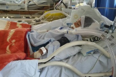 قزوین| اعلام جزییات حمله سگ به کودک ۵ ساله