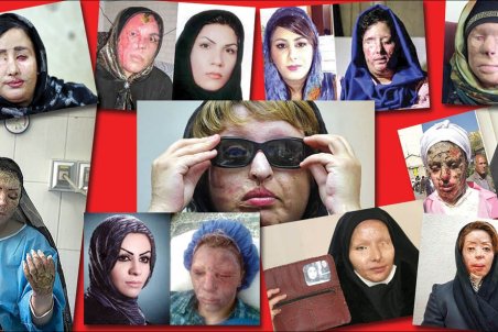 مجازات اسید پاشی مشمول هیچگونه تخفیفی نمی‌شود