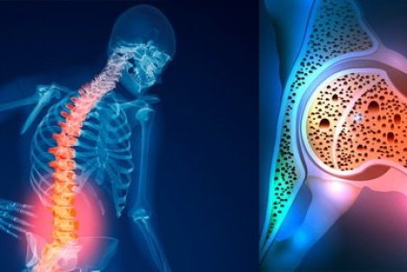 چگونه استخوان‌های سالم داشته باشیم