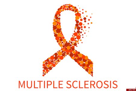 درباره بیماری ام اس بیشتر بدانید