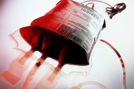 کاهش خطر ابتلا به سکته قلبی با اهدا خون