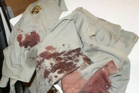 شدت سوختگی عامل فوت محیط بان دزفولی