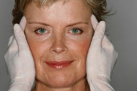 رایج‌ترین جراحی‌های زیبایی در جهان