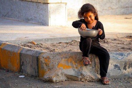 کرمان| کودکان فقیر در دام سوءتغذیه