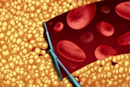 راهکارهایی ساده برای کاهش کلسترول بد