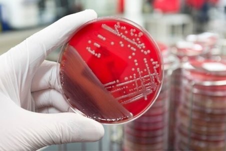 میکرو ارگانیسم های ساخت ایران برای نخستین بار صادر شد