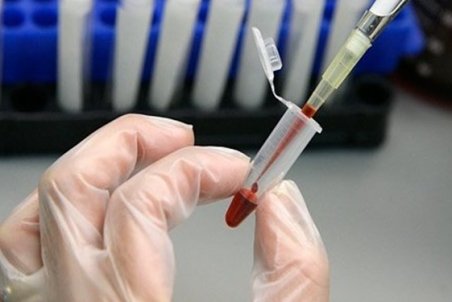 توضیح وزارت بهداشت در مورد ادعای ساکنان روستا در مورد ابتلا به  ایدز