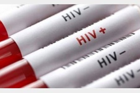 نحوه‌ی ابتلای اهالیِ روستای چنار محمودی به ایدز