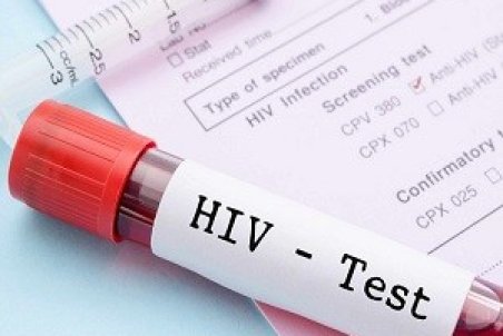 معاون وزیر بهداشت: بر اساس پروتکل وزارت برای شناسایی مبتلایان به HIV اقدام می‌شود
