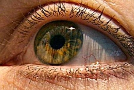 علائم و خطرات "سکته چشمی"