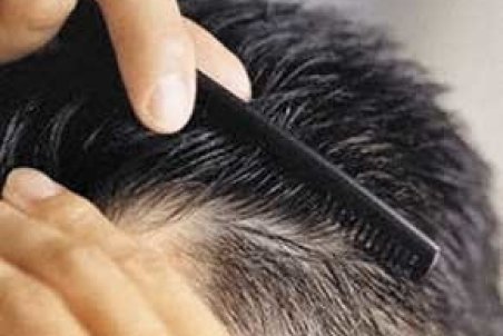 عوامل سفیدی زودرس موها