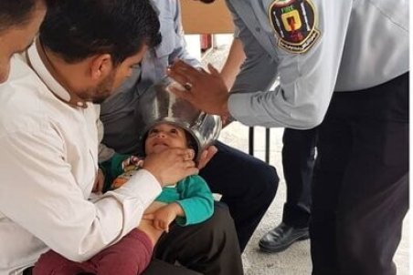 گیر کردن سر کودک یکساله بازیگوش در زودپز! / عکس