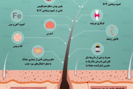 عوامل مؤثر در سفیدی زودرس مو +اینفوگرافی