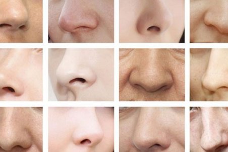 سیر تا پیاز علل بروز مشکلات تنفسی بعد از جراحی بینی