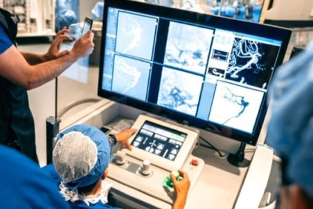 نخستین جراحی «آنوریسم مغز» با کمک ربات انجام شد