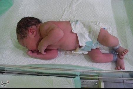 دیوان عدالت: "مرخصی زایمان" جزو ایام تعهد پزشکان متخصص محسوب نمی‌شود