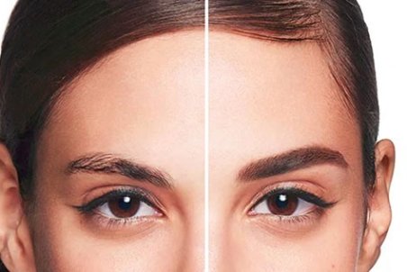 قیمت کاشت ابرو