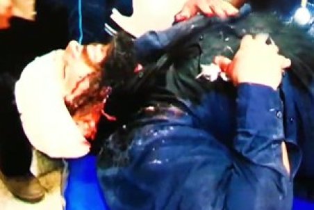 ناگفته‌های یک بسیجی جانباز از اغتشاشات اخیر + فیلم