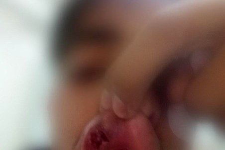 ضرب‌وشتم دانش‌آموز زنجانی توسط معلم ورزش + عکس