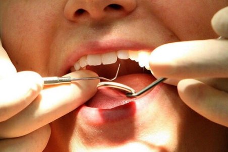 از بین بردن جرم دندان با روش‌های طبیعی