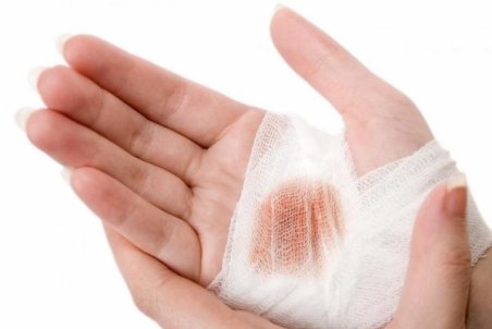 زخم‌هایی که می‌تواند سبب مرگ بیمار شود