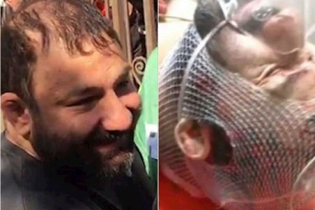 «هانی کرده» زنده است + جزئیات درگیری شب گذشته اراذل