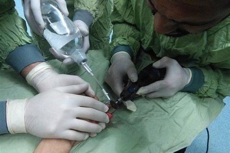 فرورفتن قطعه فلزی در دست کارگر جوان + تصاویر