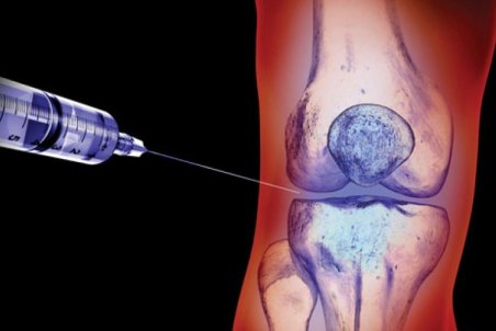 عوارض چهار زانو نشستن