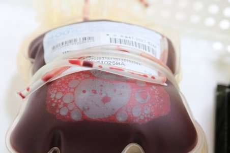 گروه خونی بیشتر ایرانی‌ها چیست؟