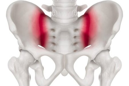 درد مفصل ساکروایلیاک (SI) را چگونه تسکین دهیم؟