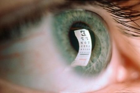 آيا عمل ليزيک چشم مفيد است؟