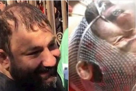 هانی کُرده پس از ۸ روز از بیمارستان مرخص شد