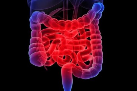 بیماری‌های التهابی روده (IBD) و غذاهای مفید برای آن