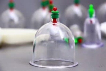 بهترین زمان حجامت چه موقع است؟