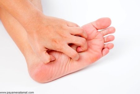 3 عامل مهم خارش کف پا